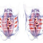 neumoperitoneo y las problematicas de las hernias